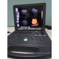 DW-C60 DAWEI Portable Laptop 4D Color Doppler Ultrasound System Machine Factory Price with CE ISO Approval